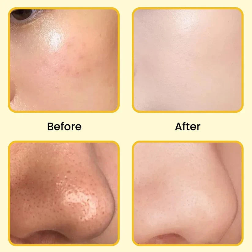 Gold Peel off Mask - Anti-Wrinkle, 98.4% Gold, Anti-Aging, Moisturizing, Removes Blackheads