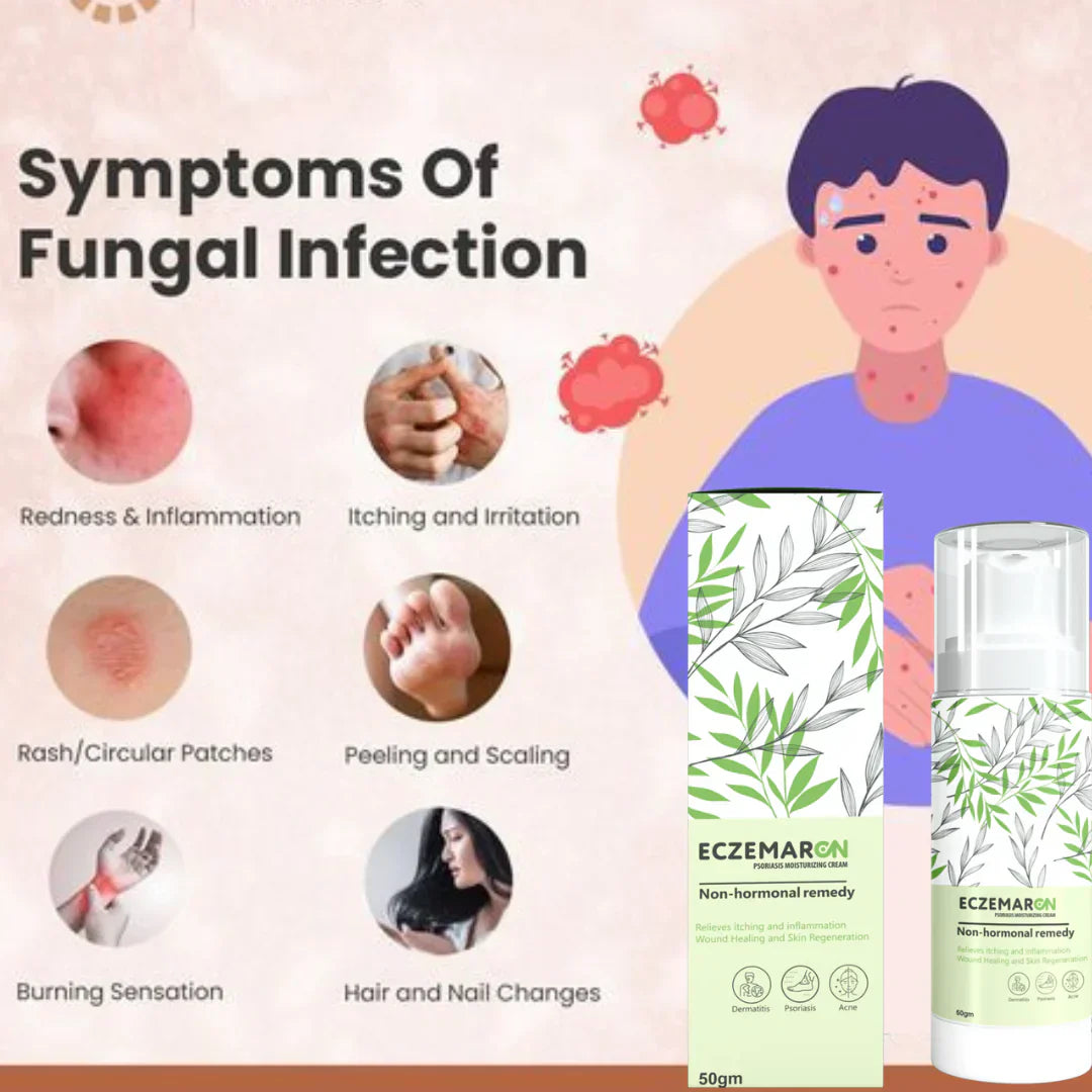 Eczemaron Anti Fungal Cream (🔥Buy 1 Get 1 Free🔥)