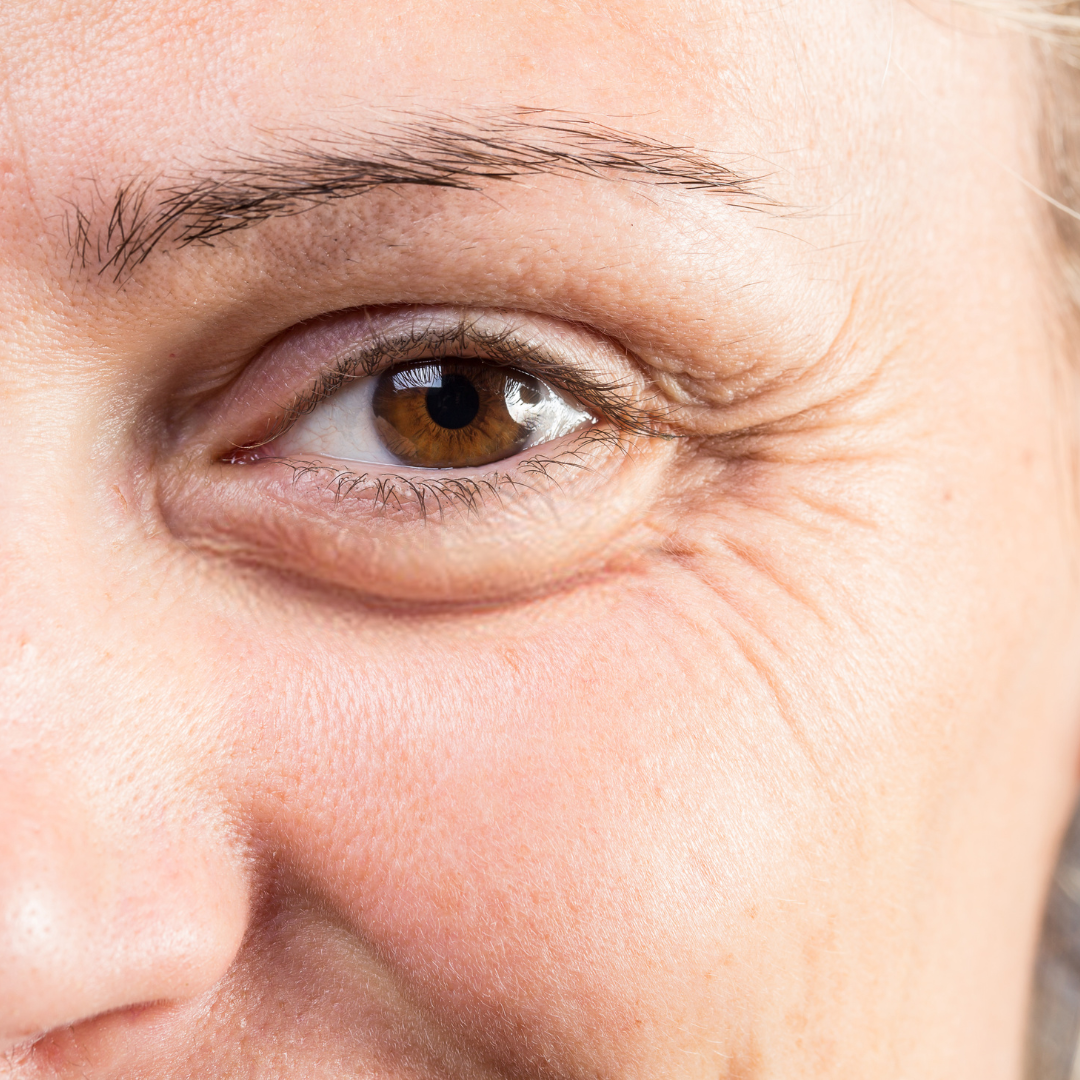 Glo Labs Extra Whitening Cream